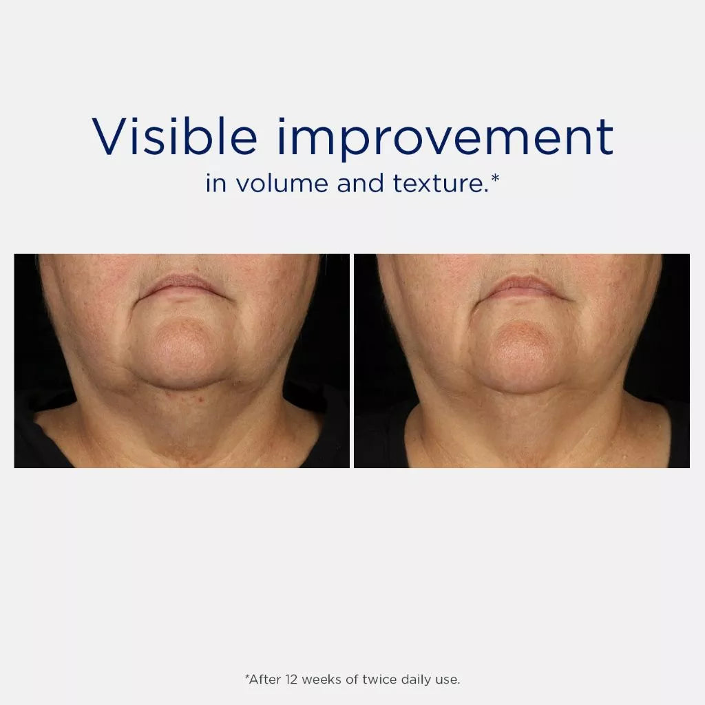 Neostrata Skin Active Tri-Therapy Serum