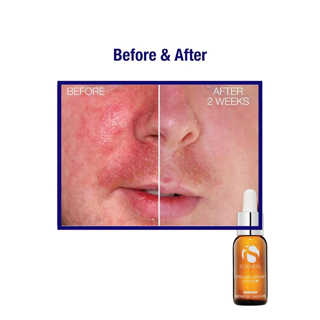 iS Clinical Pro Health Serum Advance+