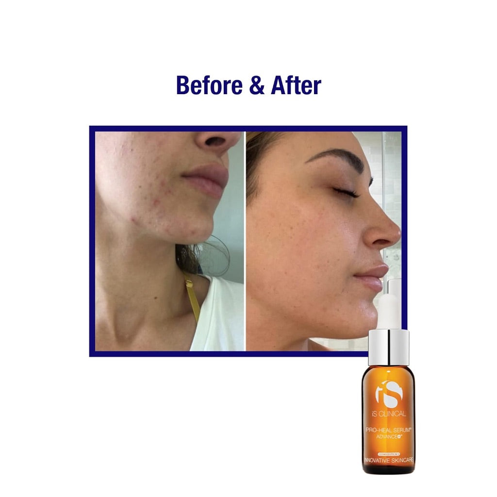 iS Clinical Pro Health Serum Advance+