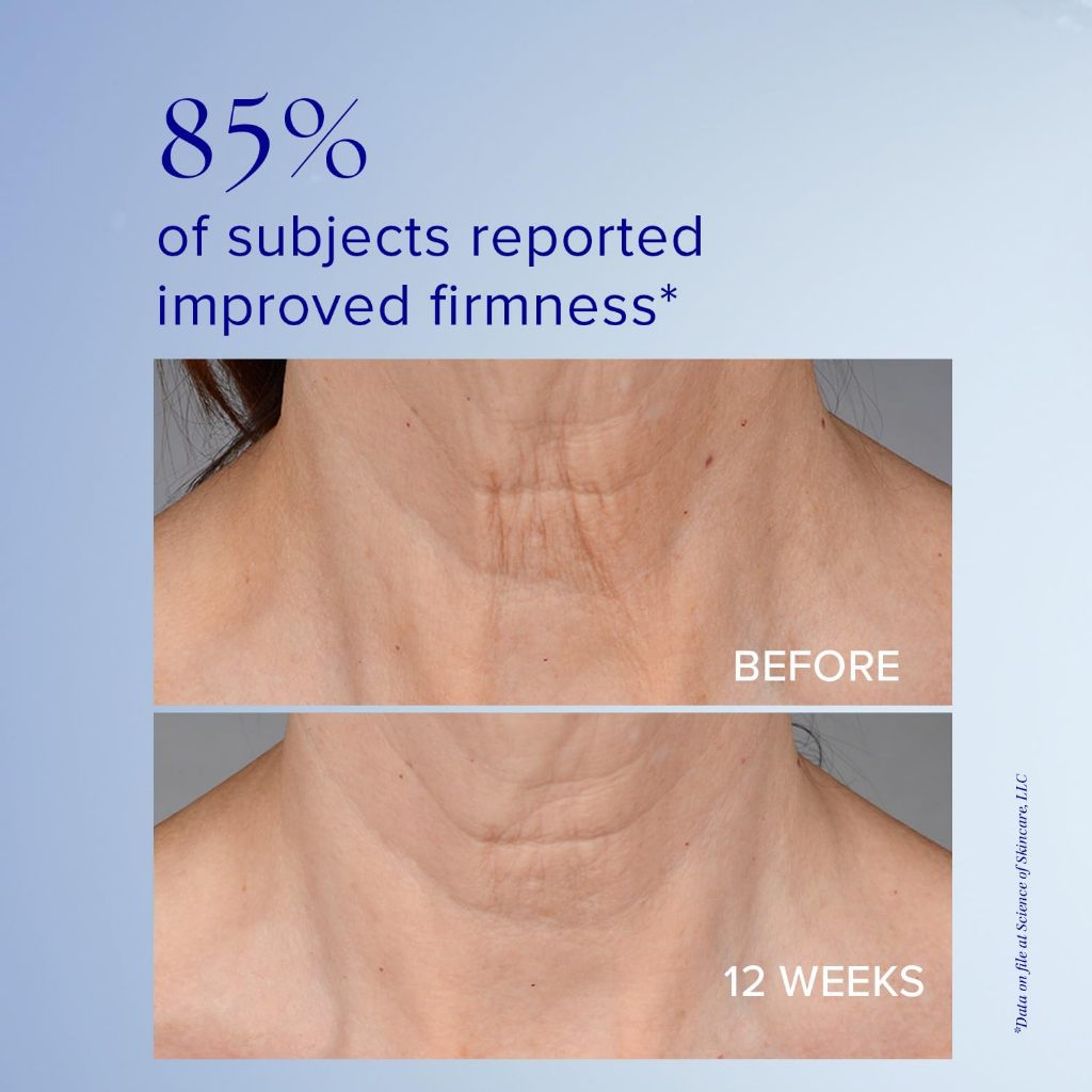 iS Clinical NeckPerfect Complex