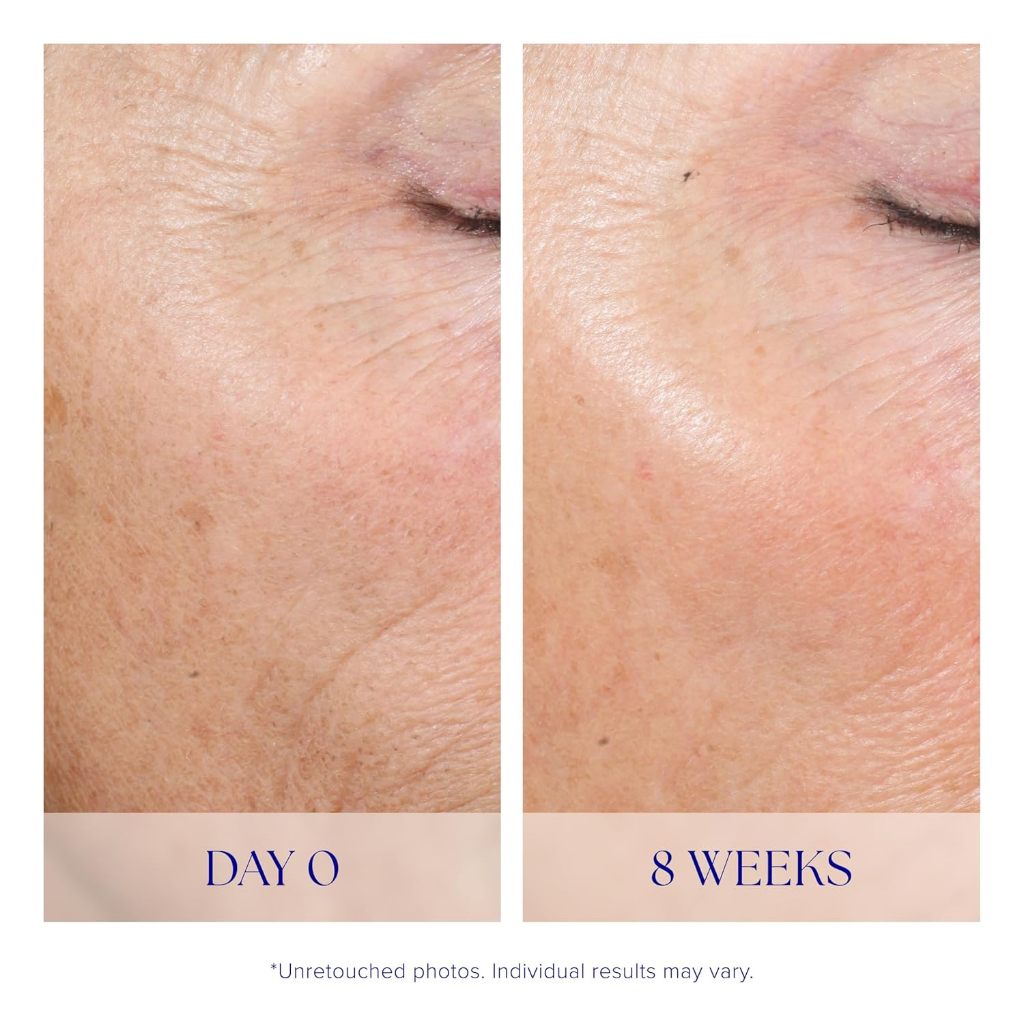 iS Clinical Active Peel System