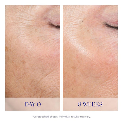 iS Clinical Active Peel System