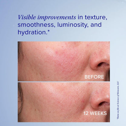 iS Clinical Retinol Emulsion 0.3