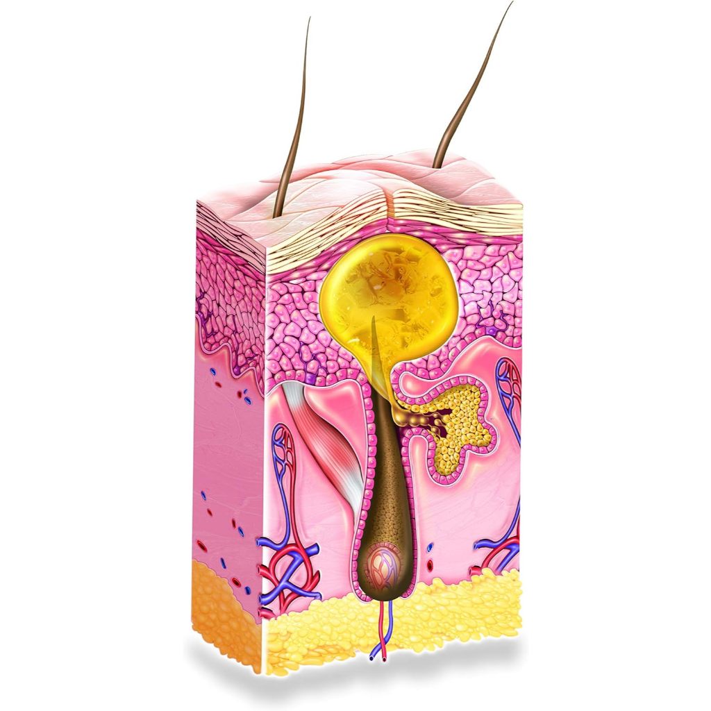 Isispharma Teen Derm A-Pure