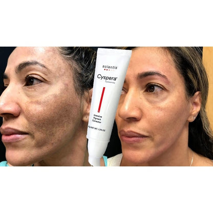 Cyspera Intensive Pigment Corrector