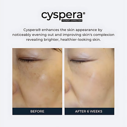 Cyspera Intensive System